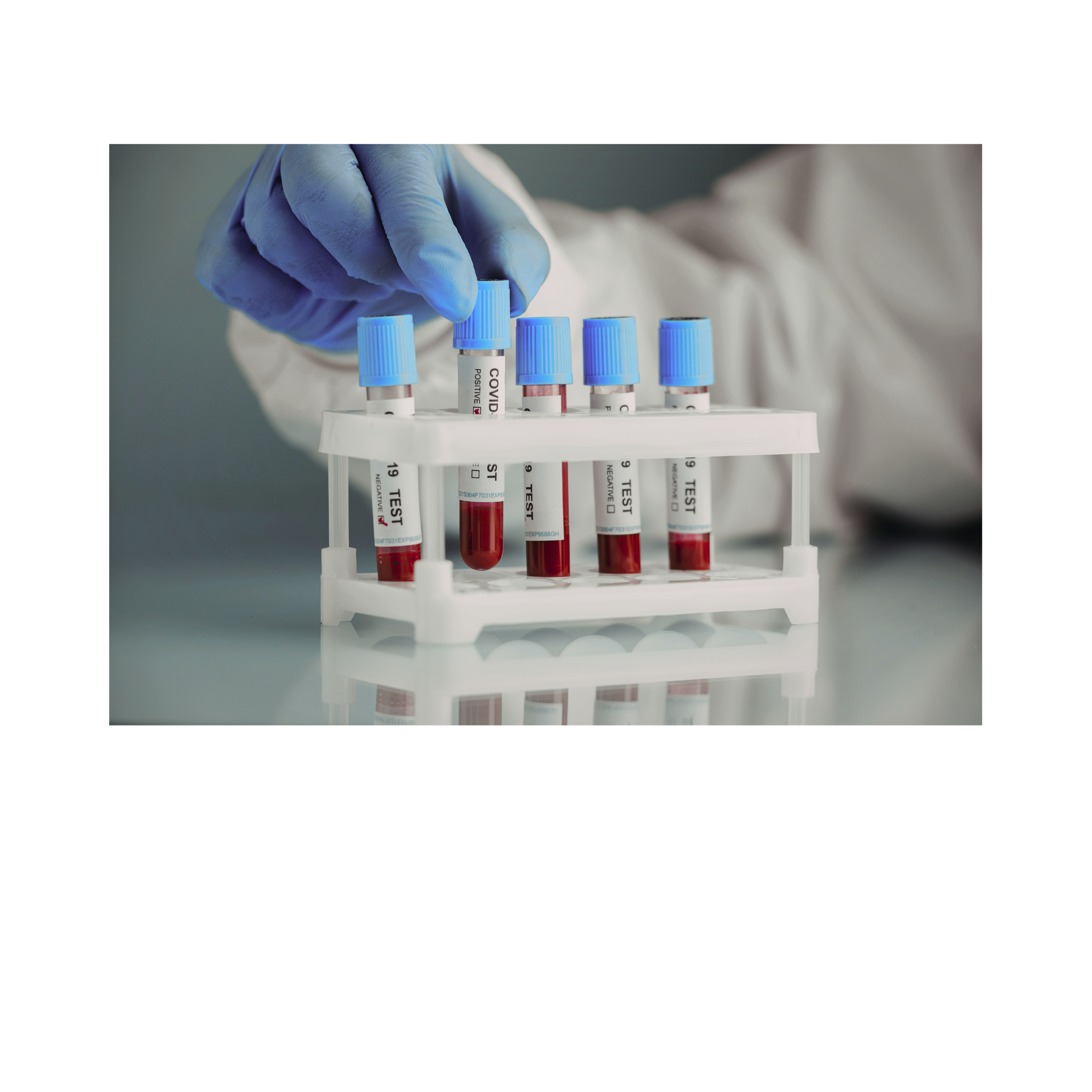 Laboratory sample tubes prepared for controlled analysis